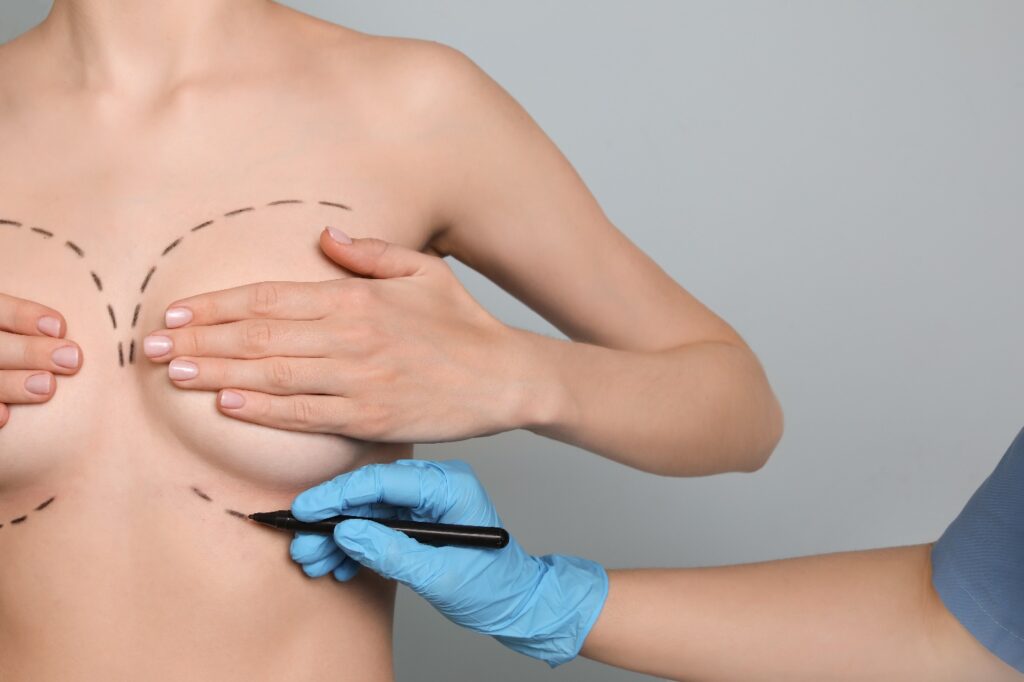 Изображение к статье "Липофилинг груди: плюсы и минусы процедуры"