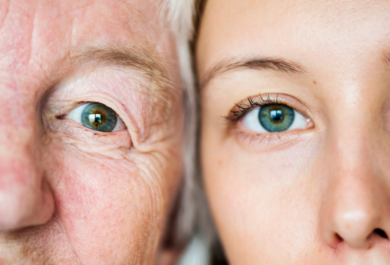 Подробнее о статье Типы старения кожи лица: описание и советы по уходу