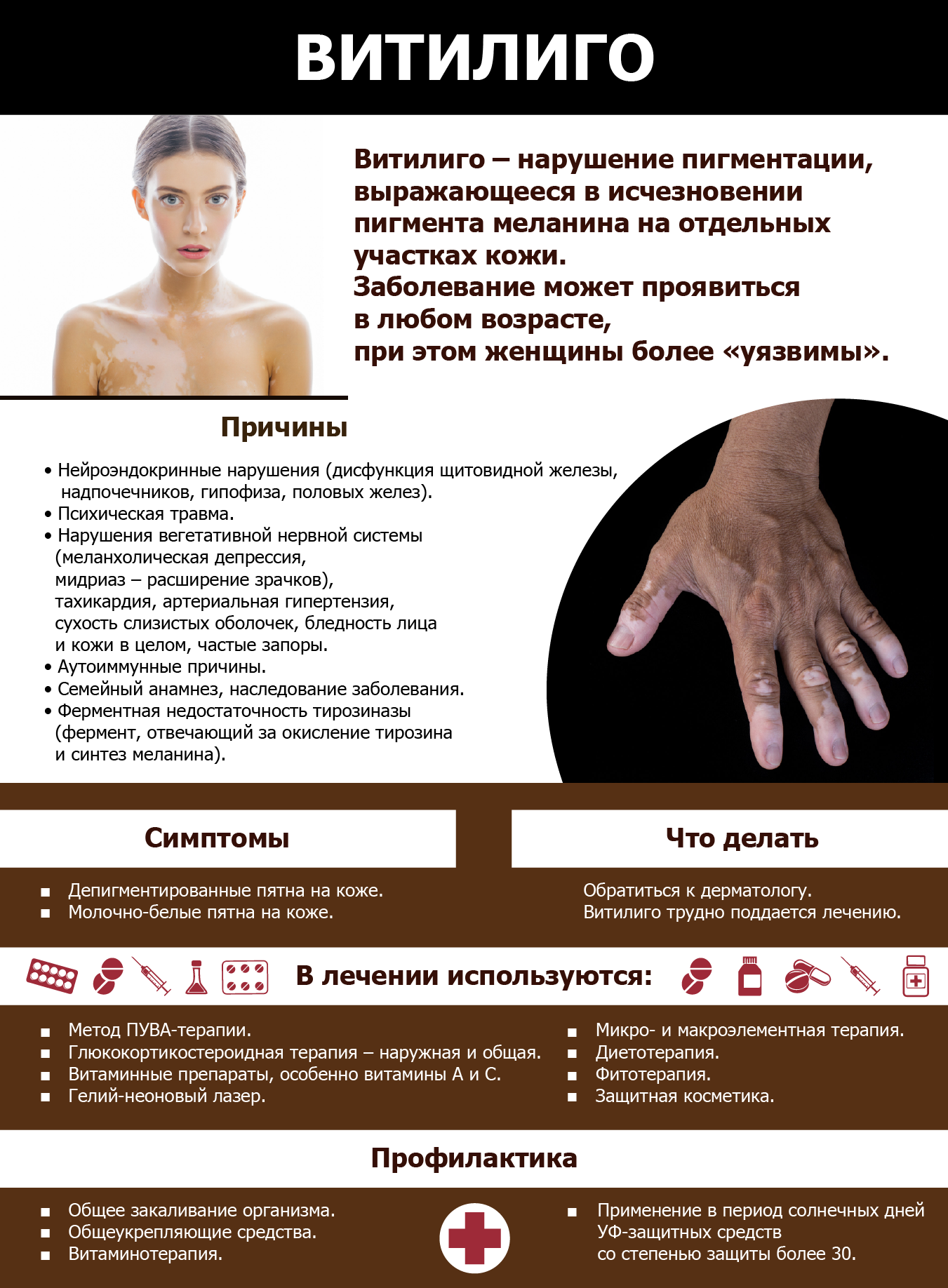 Витилиго кожи: причины и лечение