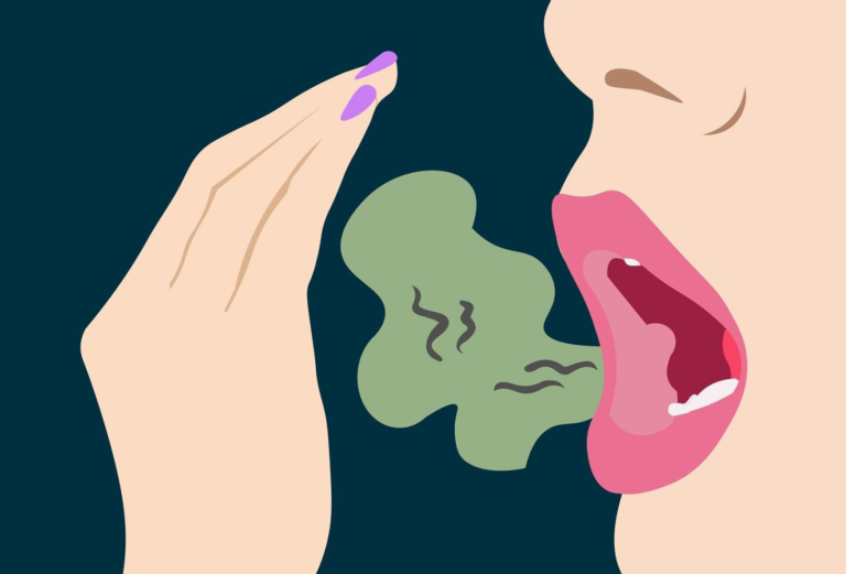 Подробнее о статье Неприятный запах изо рта: причины