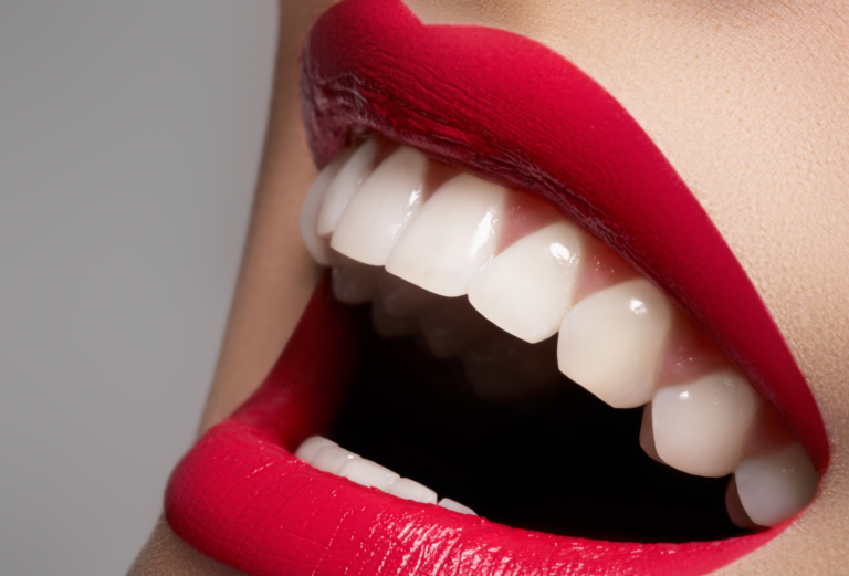Подробнее о статье Отбеливание зубов в домашних условиях